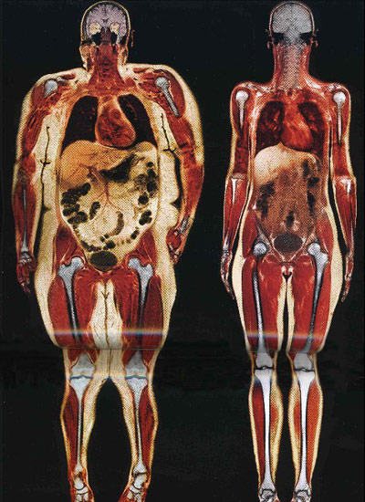 Comparacion del cuerpo de dos mujeres